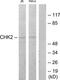 Serine/threonine-protein kinase Chk2 antibody, TA312770, Origene, Western Blot image 