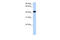 Creatine Kinase, Mitochondrial 2 antibody, ARP41479_P050, Aviva Systems Biology, Western Blot image 