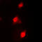 RAD51 Paralog C antibody, LS-C358269, Lifespan Biosciences, Immunofluorescence image 
