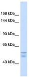 ATPase Copper Transporting Alpha antibody, TA334643, Origene, Western Blot image 