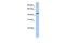 TRNA Methyltransferase 11 Homolog antibody, GTX46221, GeneTex, Western Blot image 