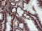 Tripartite Motif Containing 38 antibody, LS-C174624, Lifespan Biosciences, Immunohistochemistry paraffin image 