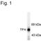 Tryptophan 5-hydroxylase 1 antibody, PA1-4678, Invitrogen Antibodies, Western Blot image 