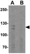Calcium Sensing Receptor antibody, GTX31574, GeneTex, Western Blot image 