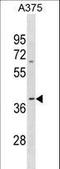 Olfactory Receptor Family 13 Subfamily D Member 1 antibody, LS-C158011, Lifespan Biosciences, Western Blot image 