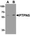 Protein Tyrosine Phosphatase Non-Receptor Type 5 antibody, A05405, Boster Biological Technology, Western Blot image 