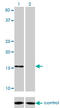 NADH:Ubiquinone Oxidoreductase Subunit B7 antibody, LS-C197760, Lifespan Biosciences, Western Blot image 