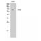 Checkpoint Kinase 2 antibody, LS-C382707, Lifespan Biosciences, Western Blot image 