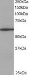 Coronin 1A antibody, TA302455, Origene, Western Blot image 