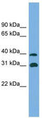 Crystallin Mu antibody, TA340030, Origene, Western Blot image 