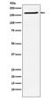 Structural Maintenance Of Chromosomes 4 antibody, M04887, Boster Biological Technology, Western Blot image 