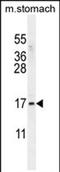 Zinc Finger Protein 428 antibody, PA5-71584, Invitrogen Antibodies, Western Blot image 