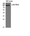 RB Transcriptional Corepressor 1 antibody, A00039T826, Boster Biological Technology, Western Blot image 