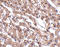 MET Transcriptional Regulator MACC1 antibody, A04732, Boster Biological Technology, Immunohistochemistry frozen image 