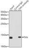 Thioredoxin antibody, GTX64390, GeneTex, Immunoprecipitation image 