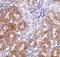 LIAR antibody, GTX85269, GeneTex, Immunohistochemistry paraffin image 