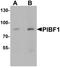 Progesterone Immunomodulatory Binding Factor 1 antibody, orb179055, Biorbyt, Western Blot image 