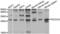 Programmed Cell Death 10 antibody, LS-C332244, Lifespan Biosciences, Western Blot image 