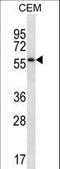 Motile Sperm Domain Containing 2 antibody, LS-C164281, Lifespan Biosciences, Western Blot image 