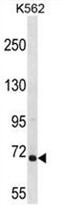 Rac/Cdc42 Guanine Nucleotide Exchange Factor 6 antibody, AP50239PU-N, Origene, Western Blot image 