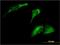 ADP Ribosylation Factor Like GTPase 8A antibody, H00127829-M02, Novus Biologicals, Immunocytochemistry image 