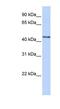 UDP-GlcNAc:BetaGal Beta-1,3-N-Acetylglucosaminyltransferase 4 antibody, NBP1-55107, Novus Biologicals, Western Blot image 