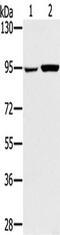 Glycogen Phosphorylase L antibody, TA350315, Origene, Western Blot image 