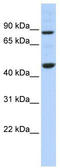 Protein Phosphatase Methylesterase 1 antibody, TA345059, Origene, Western Blot image 