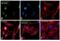 Ribosomal Protein S6 Kinase A1 antibody, PA5-38309, Invitrogen Antibodies, Immunofluorescence image 