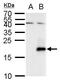 Secretin antibody, PA5-35973, Invitrogen Antibodies, Western Blot image 