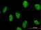N-Methylpurine DNA Glycosylase antibody, H00004350-M04, Novus Biologicals, Immunocytochemistry image 