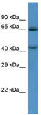 Transmembrane Channel Like 7 antibody, TA338683, Origene, Western Blot image 