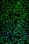 Eukaryotic Translation Initiation Factor 4E antibody, LS-C746741, Lifespan Biosciences, Immunofluorescence image 