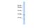 Centriole, Cilia And Spindle Associated Protein antibody, GTX45690, GeneTex, Western Blot image 