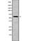 Arylsulfatase B antibody, abx148354, Abbexa, Western Blot image 