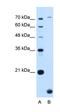 Transmembrane Protein 91 antibody, orb325194, Biorbyt, Western Blot image 