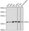 Eukaryotic Translation Initiation Factor 5A antibody, 18-449, ProSci, Immunohistochemistry paraffin image 