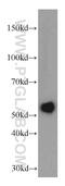 TRNA Methyltransferase 2 Homolog B antibody, 20767-1-AP, Proteintech Group, Western Blot image 