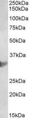 Chloride Intracellular Channel 1 antibody, LS-C204987, Lifespan Biosciences, Western Blot image 