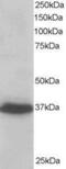 PDZ And LIM Domain 4 antibody, GTX26045, GeneTex, Western Blot image 