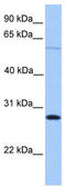 Cerebellin 4 Precursor antibody, TA340237, Origene, Western Blot image 