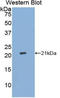 Cytoplasmic aconitate hydratase antibody, LS-C292596, Lifespan Biosciences, Western Blot image 