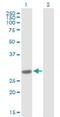 Catechol-O-Methyltransferase antibody, H00001312-B01P, Novus Biologicals, Western Blot image 