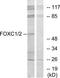 Forkhead Box C1 antibody, TA311885, Origene, Western Blot image 