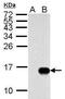 Influenza A Virus M2 antibody, PA5-32233, Invitrogen Antibodies, Western Blot image 