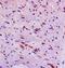 Semaphorin 3F antibody, orb11360, Biorbyt, Immunohistochemistry paraffin image 