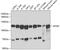 Adaptor Related Protein Complex 2 Subunit Beta 1 antibody, GTX32450, GeneTex, Western Blot image 