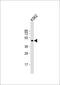 Eukaryotic translation initiation factor 5 antibody, 61-280, ProSci, Western Blot image 