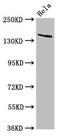 Laminin subunit gamma-2 antibody, CSB-PA618803LA01HU, Cusabio, Western Blot image 
