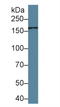 Mannose Receptor C Type 2 antibody, LS-C684961, Lifespan Biosciences, Western Blot image 